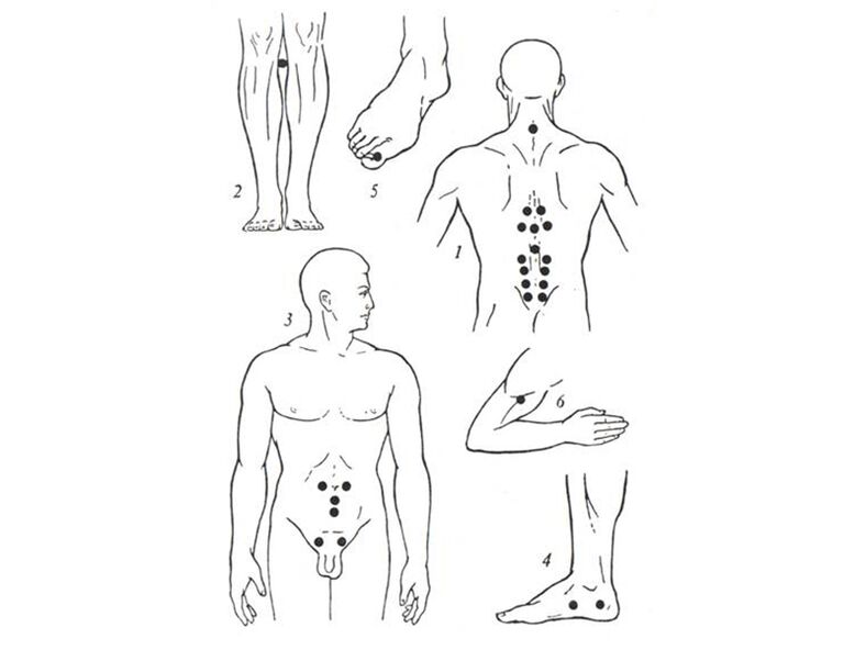 Masaje de acupuntura